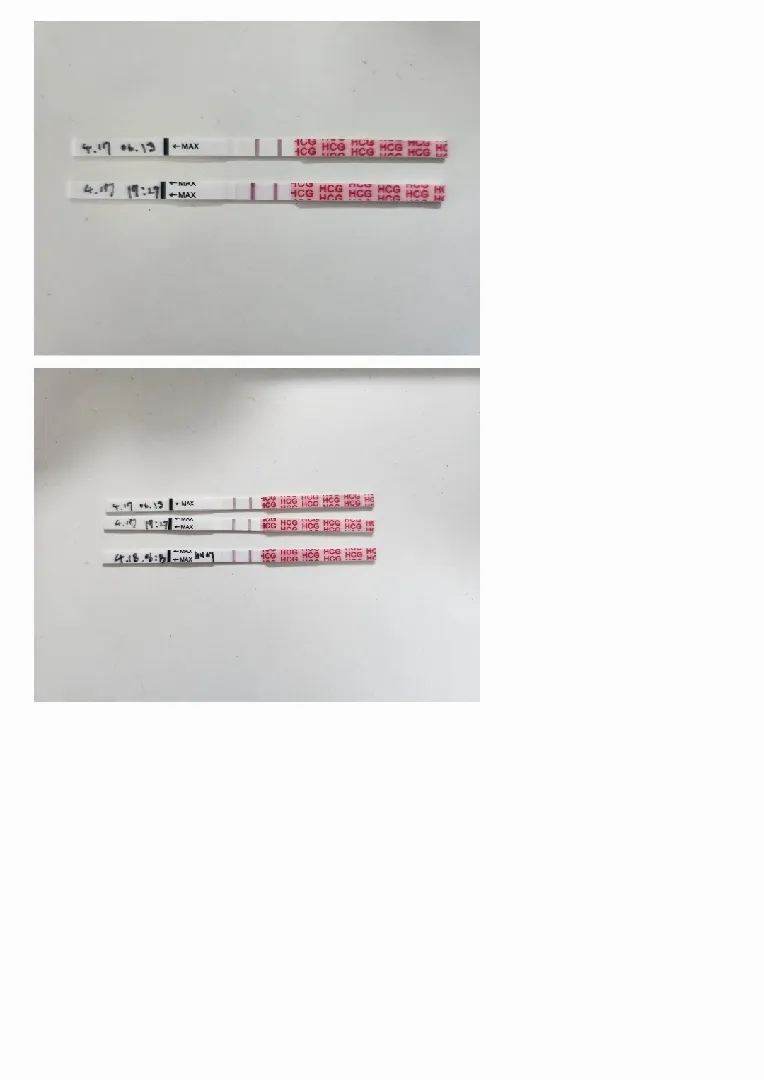임테기 문의드려요