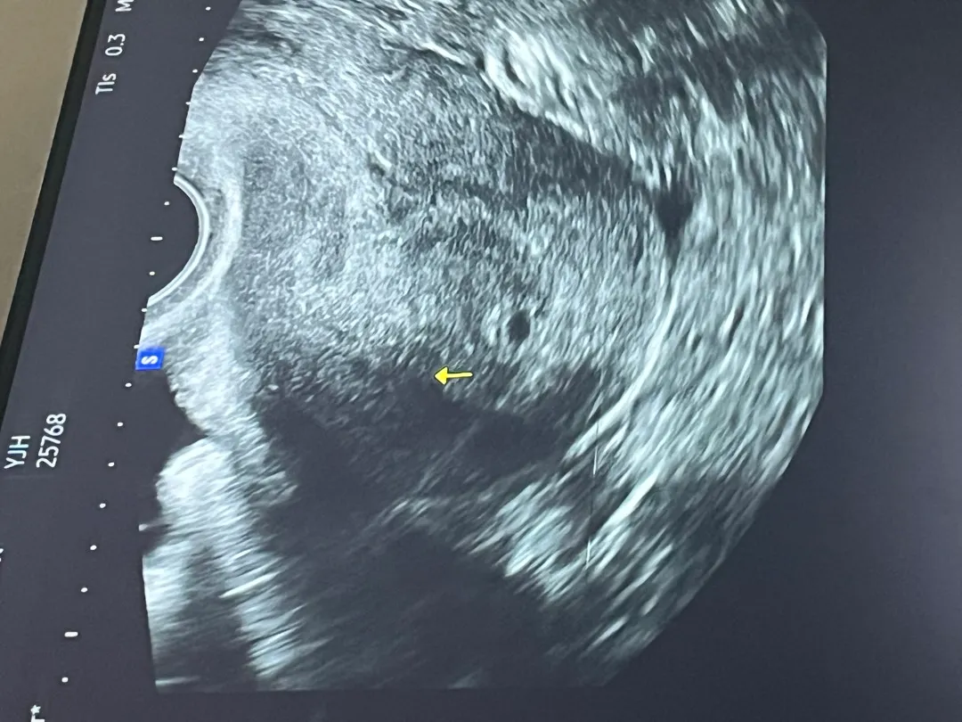 저 4월30일 예정일 받았어요