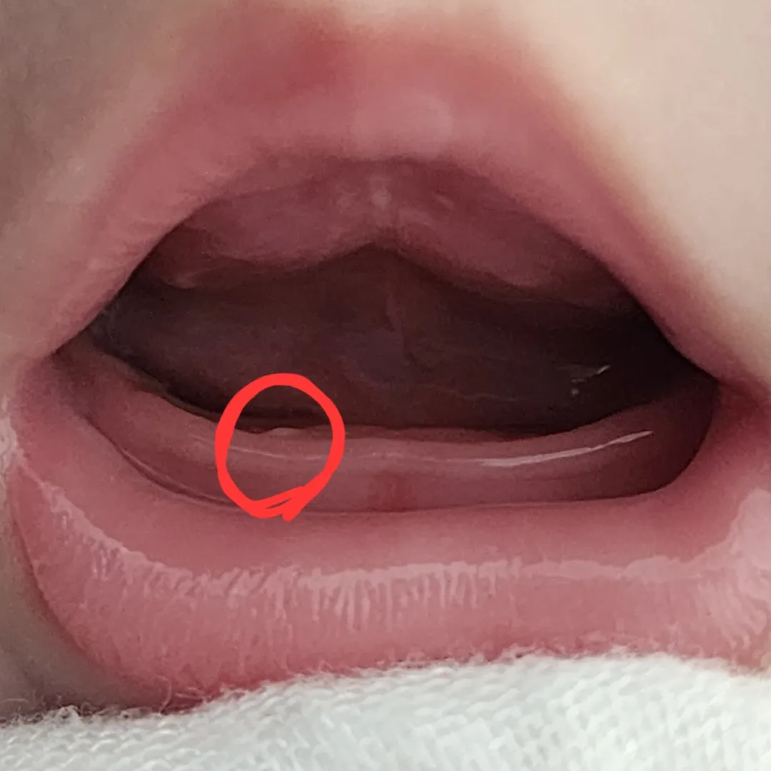 4개월 아가 이앓이?