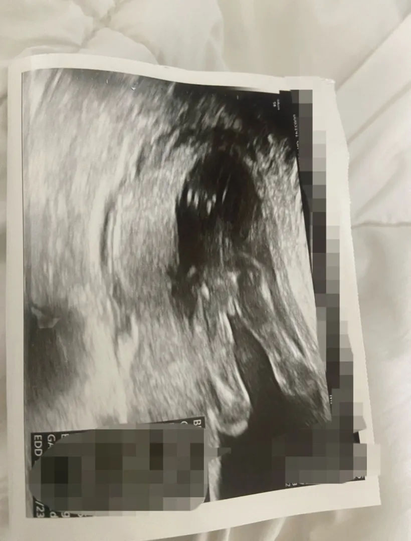 깜짝놀란 성별반전 ,,,