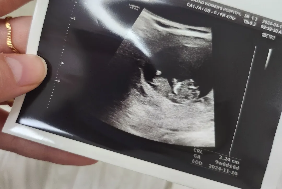 9주6일 젤리곰..?