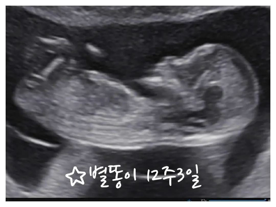 각도법 궁금해요^^
