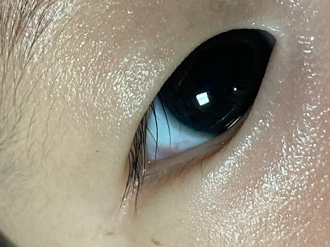 애기 눈에