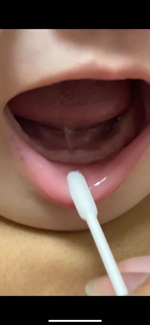 아랫니 올라오려고 하는걸까요? 