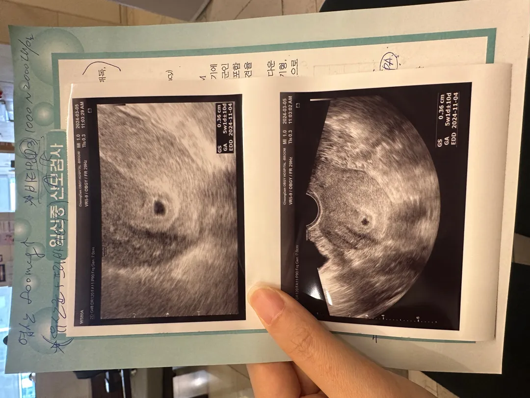 초음파사진...내가엄마라니..감격스러워요❤️