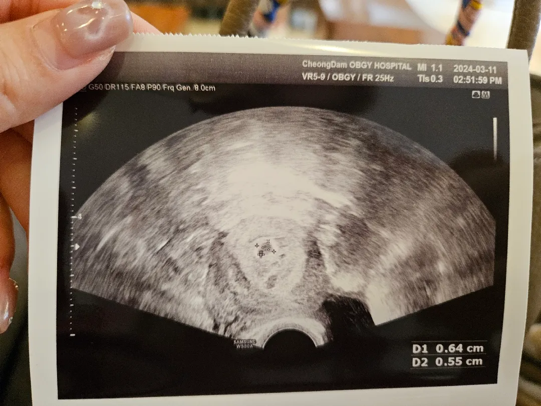 다들 아기집사진이 까맣고 크던데 