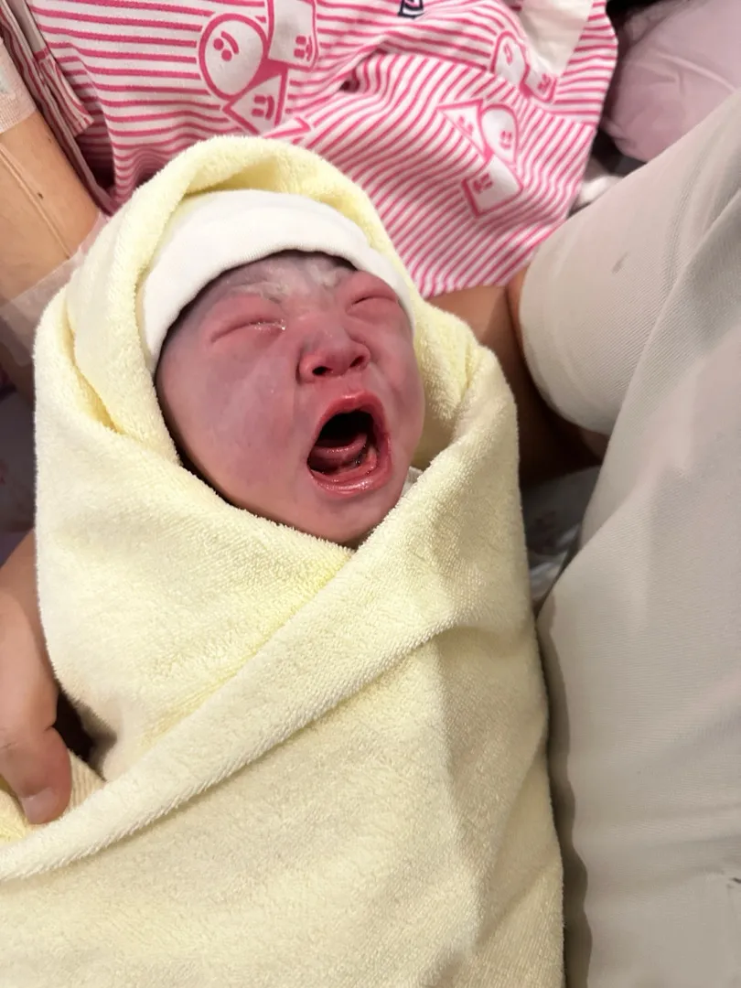 (40+1주) No이슬No진통 초산모의 유도분만 이야기