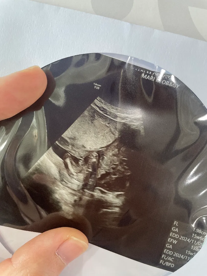 15주 다리사이에 고추인가요..?