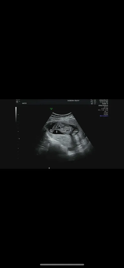 16주 성별보고왔네요~!
