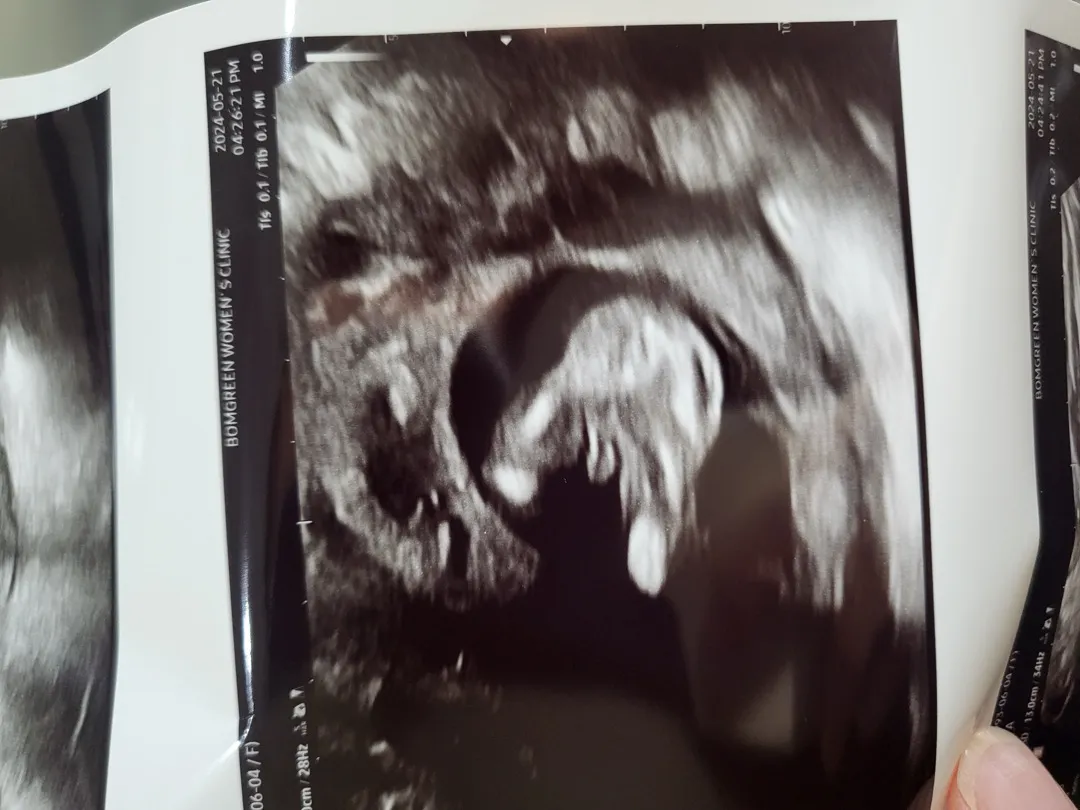 심장소리 넘나신기!! 남자아이래요👶🏻