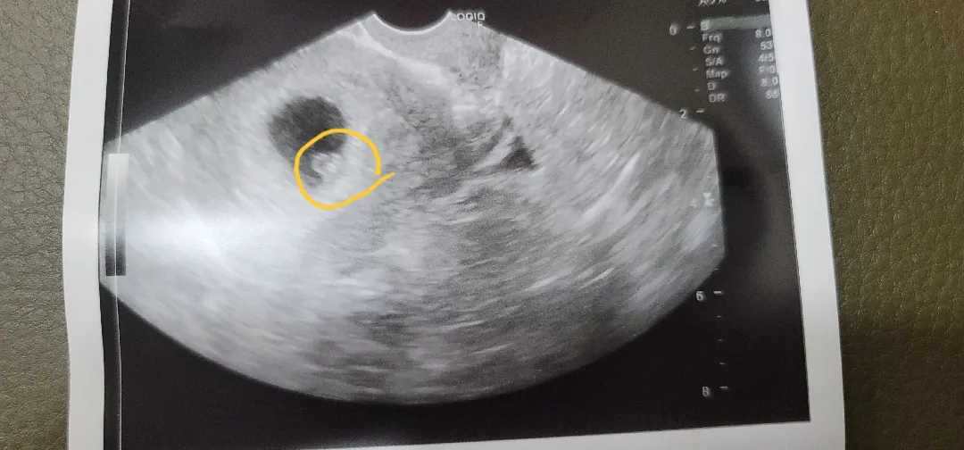저도 아가보고왔어용~~