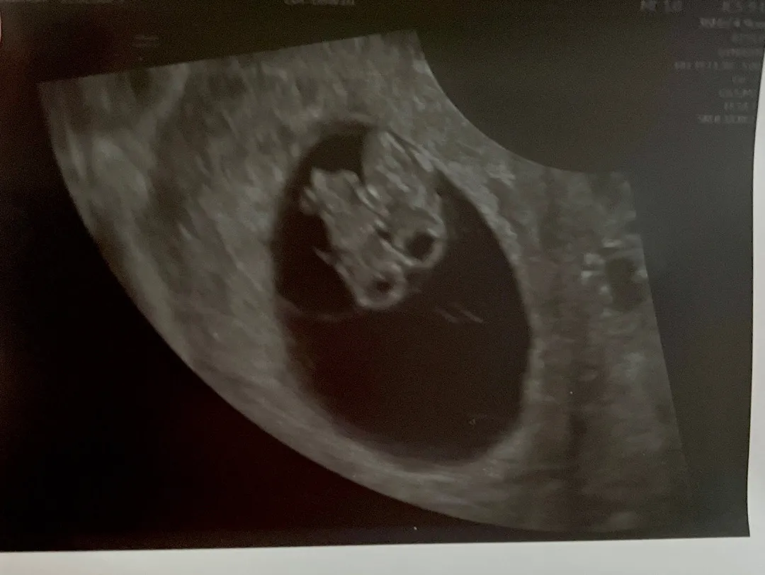 8주1일 쌍둥이 젤리곰