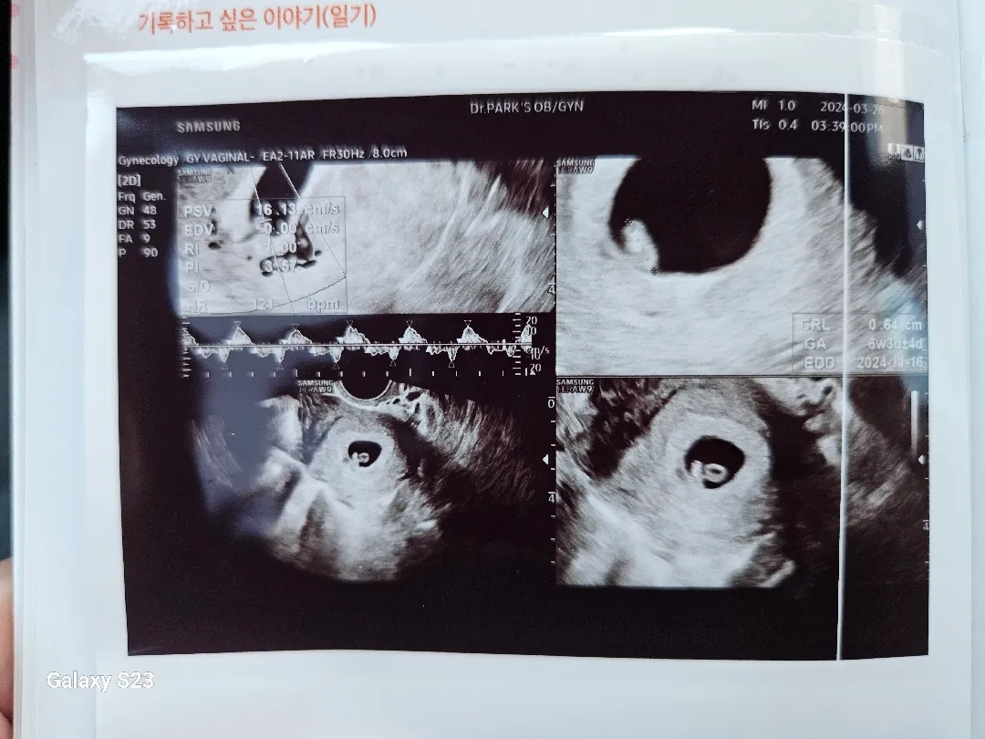 오늘 6주차 난황이랑 애기보고왓어요!