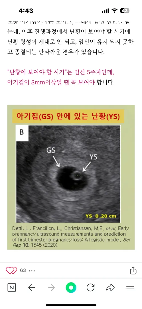저 지금 이거 보고 불안해지고 있어요 ㅠㅠㅜ 