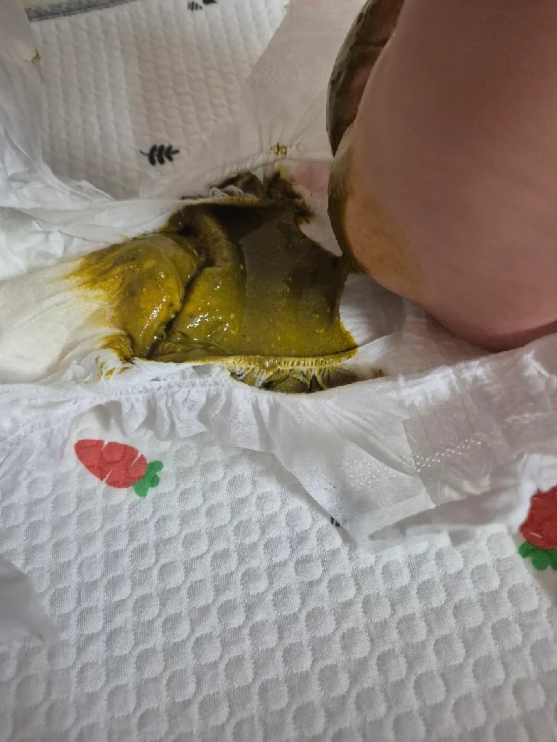 65일 아가 응가 좀 봐주세요 ㅠㅠ(사진있어요)