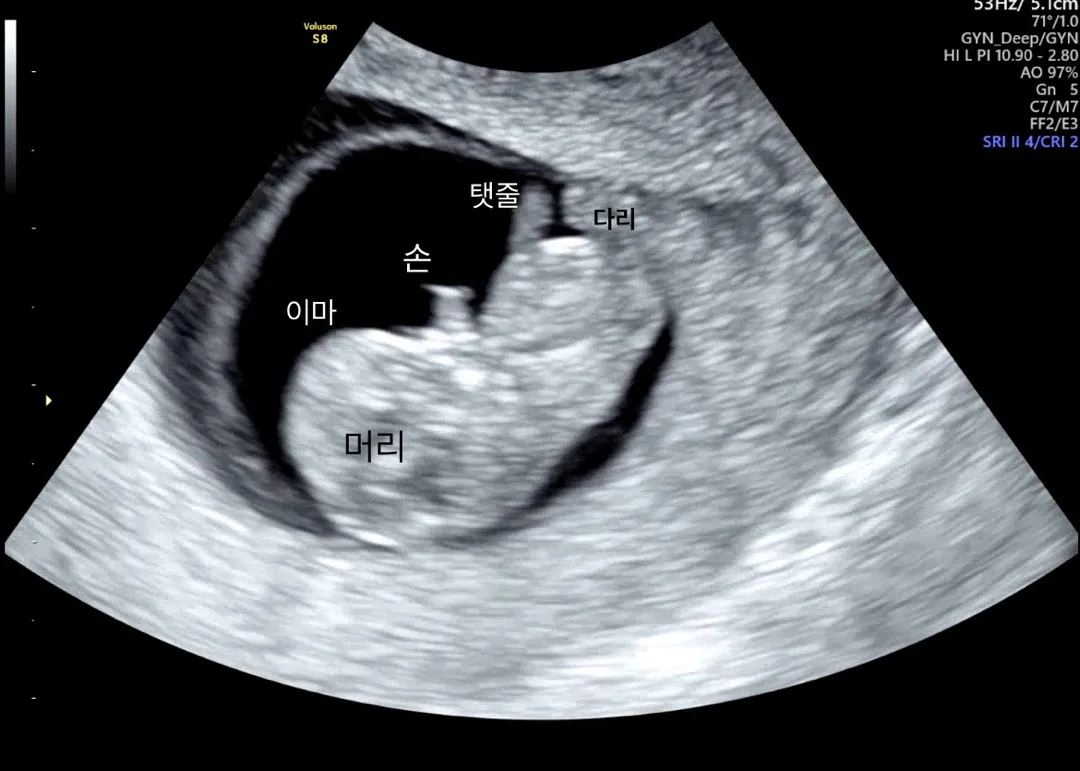 드뎌 마이 젤리곰😆🤍사랑스럽네요
